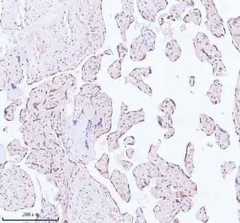 ASH2L Rabbit Polyclonal Antibody