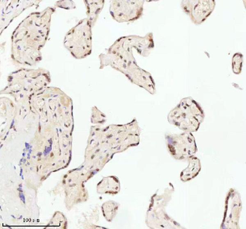 ASH2L Rabbit Polyclonal Antibody