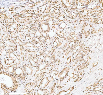 ASH2L Rabbit Polyclonal Antibody