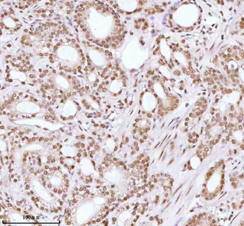 ASH2L Rabbit Polyclonal Antibody
