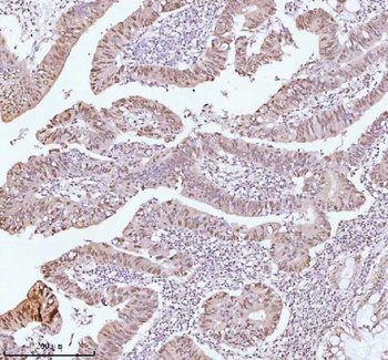 ASH2L Rabbit Polyclonal Antibody