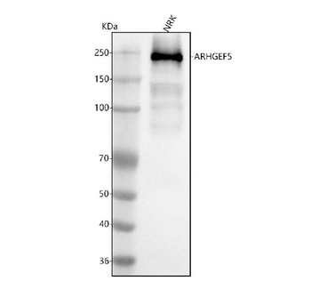 ARHGEF5 Rabbit Polyclonal Antibody