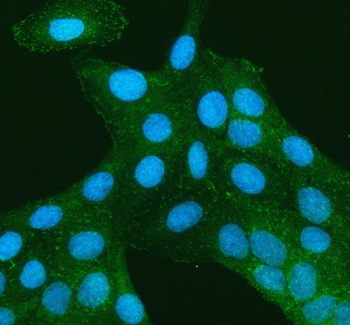 TNS3 Rabbit Polyclonal Antibody