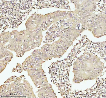 PITHD1 Rabbit Polyclonal Antibody