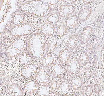 PITHD1 Rabbit Polyclonal Antibody