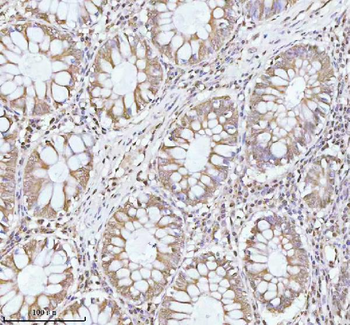 PITHD1 Rabbit Polyclonal Antibody