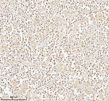 PITHD1 Rabbit Polyclonal Antibody