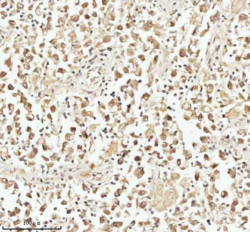 PITHD1 Rabbit Polyclonal Antibody