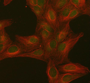PITHD1 Rabbit Polyclonal Antibody
