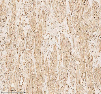 PITHD1 Rabbit Polyclonal Antibody