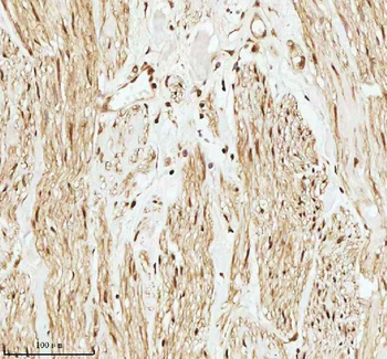 PITHD1 Rabbit Polyclonal Antibody
