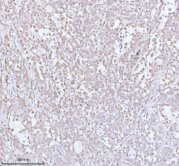PITHD1 Rabbit Polyclonal Antibody