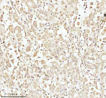 PITHD1 Rabbit Polyclonal Antibody