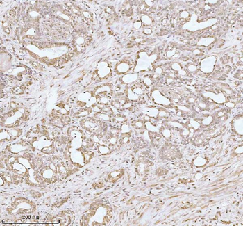 PITHD1 Rabbit Polyclonal Antibody