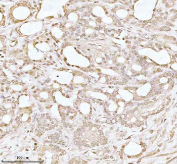 PITHD1 Rabbit Polyclonal Antibody