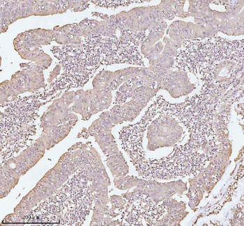 PITHD1 Rabbit Polyclonal Antibody