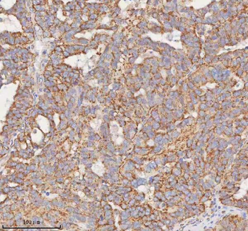 SLC7A7 Rabbit Polyclonal Antibody