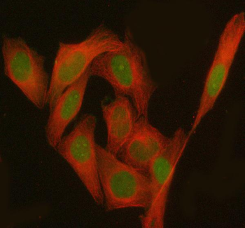 JADE1 Rabbit Polyclonal Antibody
