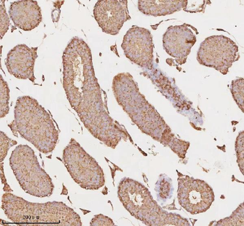 MICALL1 Rabbit Polyclonal Antibody