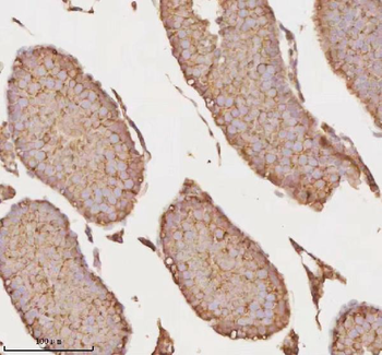 MICALL1 Rabbit Polyclonal Antibody