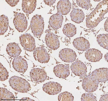 MICALL1 Rabbit Polyclonal Antibody