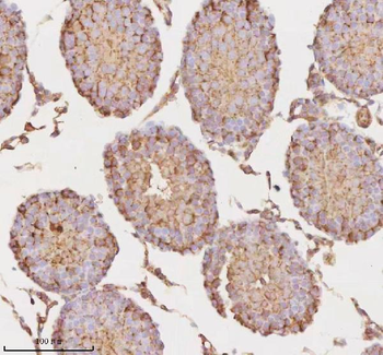 MICALL1 Rabbit Polyclonal Antibody