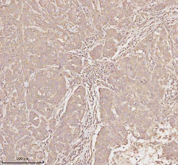 MICALL1 Rabbit Polyclonal Antibody