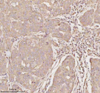MICALL1 Rabbit Polyclonal Antibody