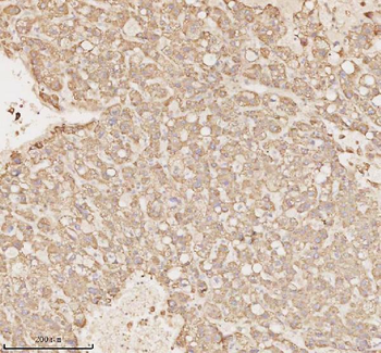 MICALL1 Rabbit Polyclonal Antibody
