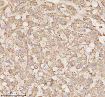MICALL1 Rabbit Polyclonal Antibody