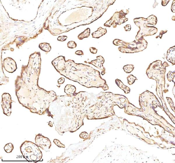 MICALL1 Rabbit Polyclonal Antibody