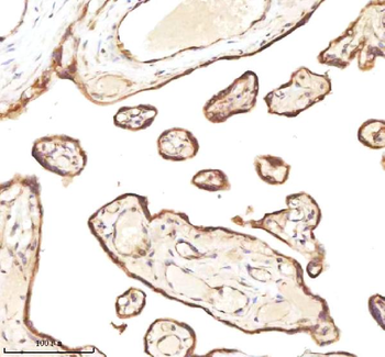 MICALL1 Rabbit Polyclonal Antibody