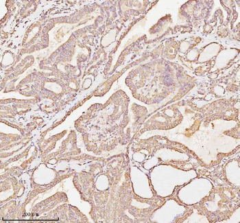 MICALL1 Rabbit Polyclonal Antibody