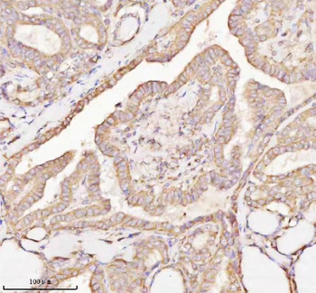 MICALL1 Rabbit Polyclonal Antibody