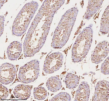 MELTF Rabbit Polyclonal Antibody