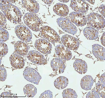 MELTF Rabbit Polyclonal Antibody