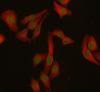 MED4 Rabbit Polyclonal Antibody
