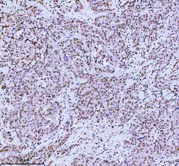 MED4 Rabbit Polyclonal Antibody