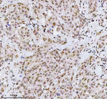 MED4 Rabbit Polyclonal Antibody