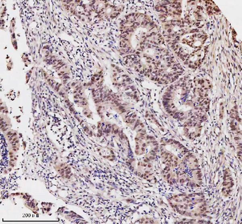 MED4 Rabbit Polyclonal Antibody
