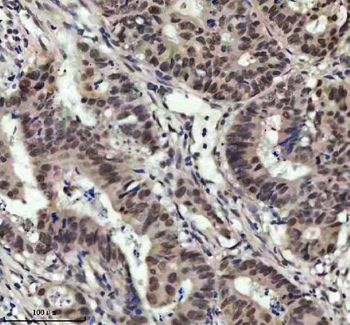 MED4 Rabbit Polyclonal Antibody
