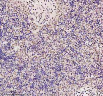 MED4 Rabbit Polyclonal Antibody