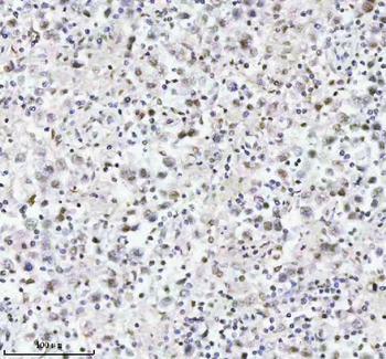 MED4 Rabbit Polyclonal Antibody