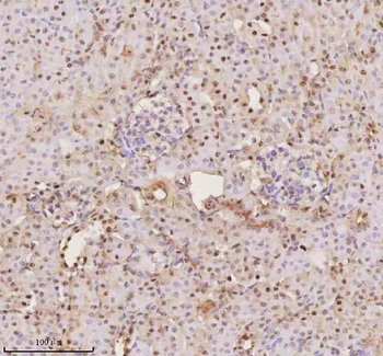 PTRHD1 Rabbit Polyclonal Antibody