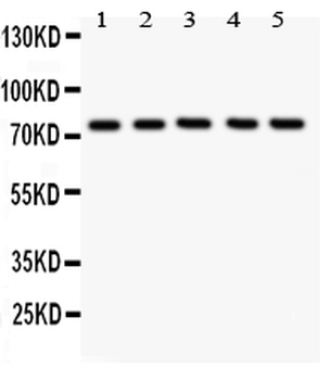 12 Lipoxygenase/ALOX12 Rabbit Polyclonal Antibody