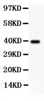 AAMP CCL18 Rabbit Polyclonal Antibody