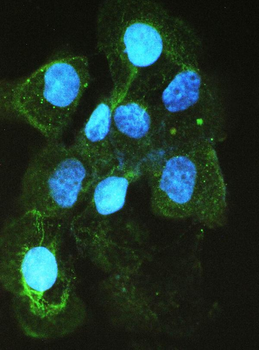 Angiotensin Converting Enzyme 1/ACE Rabbit Polyclonal Antibody