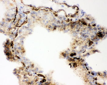 Angiotensin Converting Enzyme 1/ACE Rabbit Polyclonal Antibody