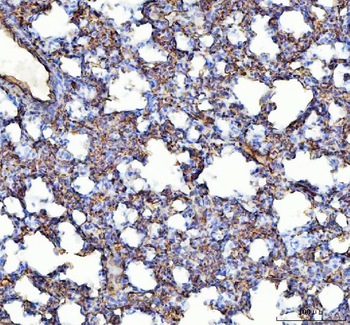 Angiotensin Converting Enzyme 1/ACE Rabbit Polyclonal Antibody