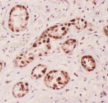 APE1/APEX1 Rabbit Polyclonal Antibody
